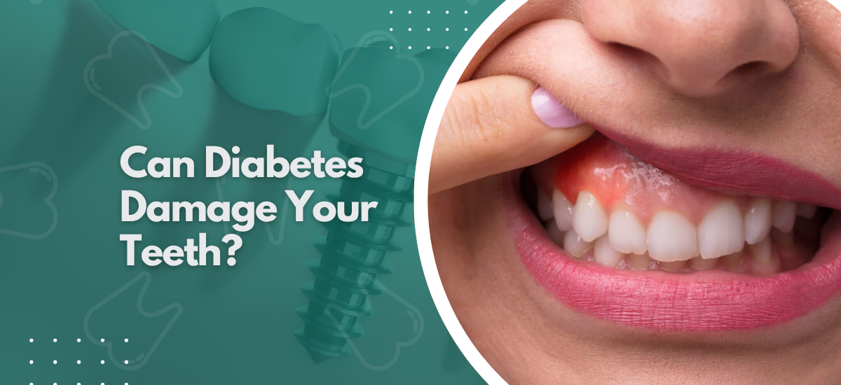 Can Diabetes Damage Your Teeth?