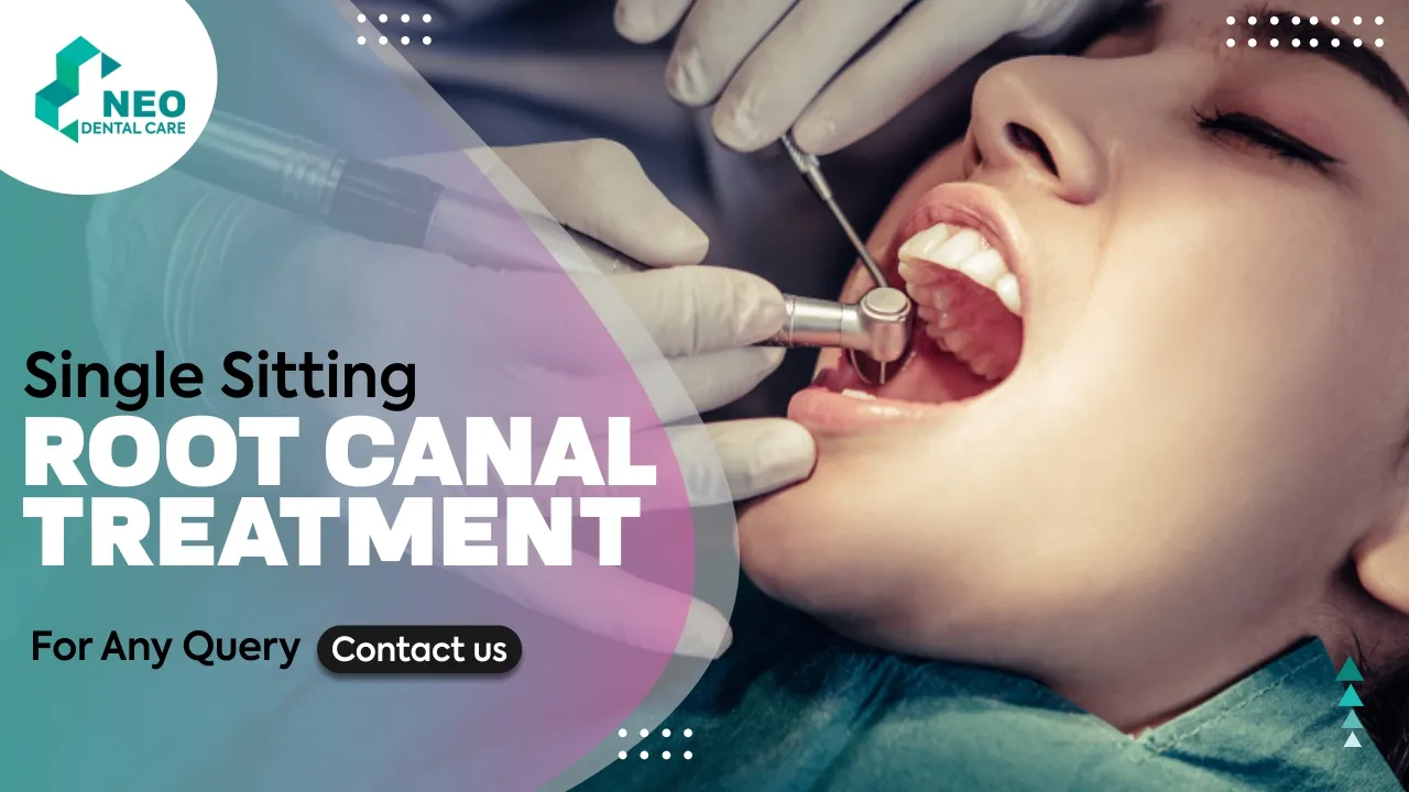 Single Sitting Root Canal Treatment: Procedure And Advantages