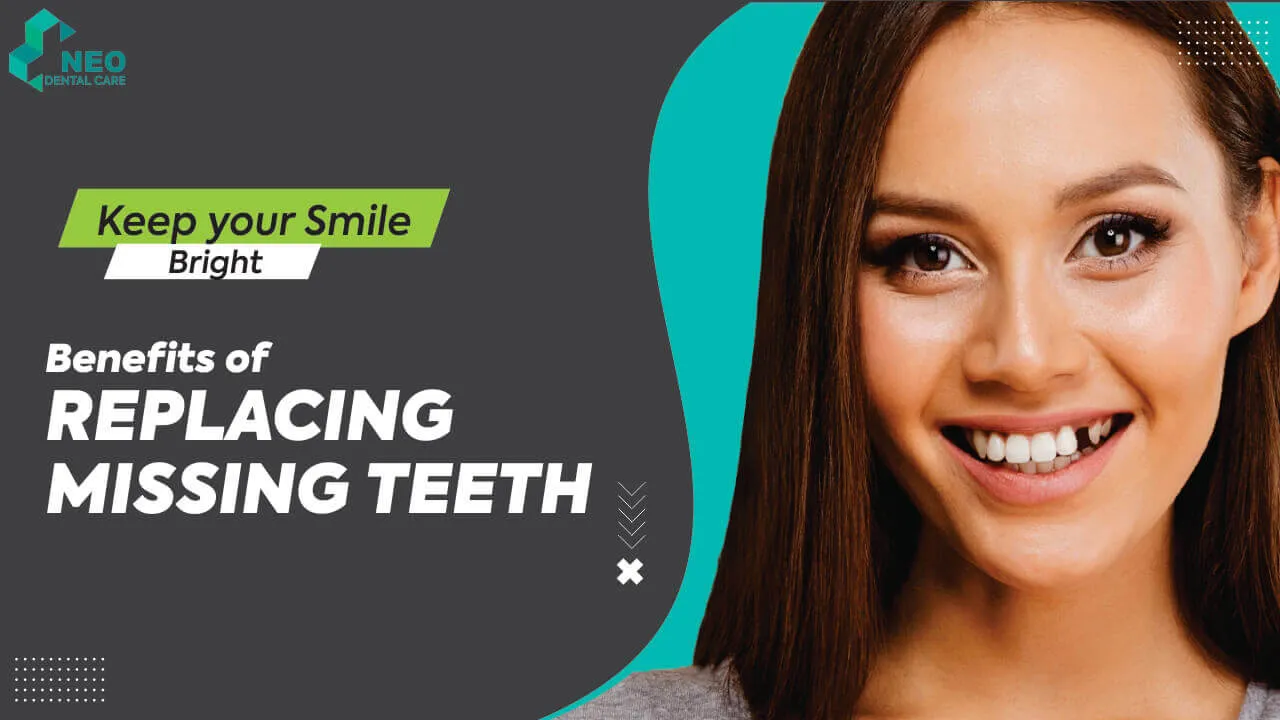 Decode the Multiple Benefits of Replacing Missing Teeth
