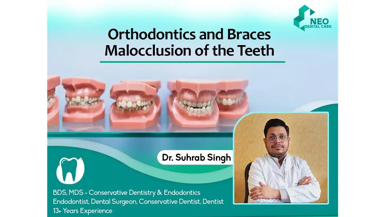 Orthodontics and Braces Malocclusion of the teeth