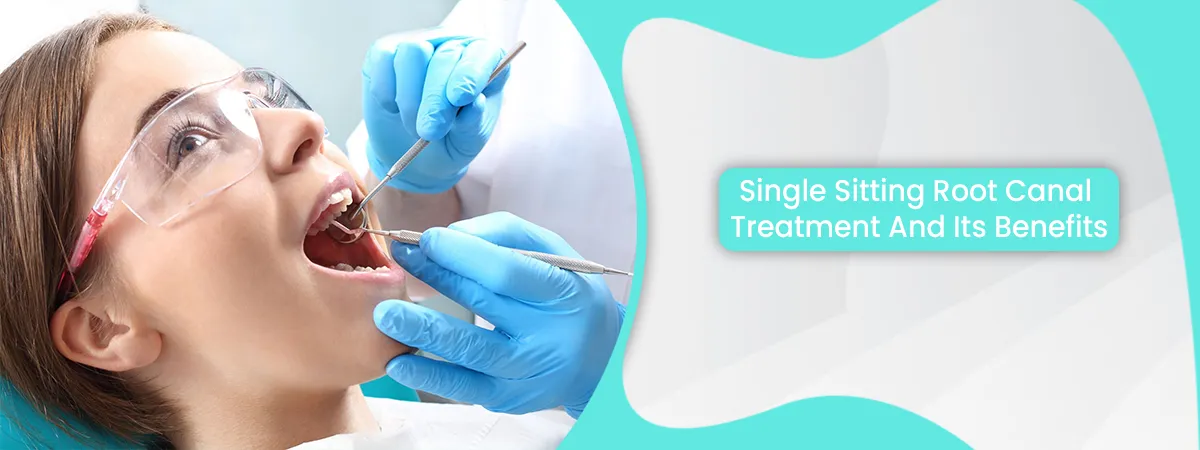 Single Sitting Root Canal Treatment And Its Benefits