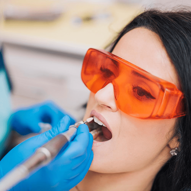 Teeth contouring why