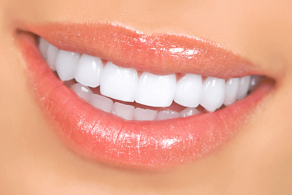 Teeth Contouring – For A Perfect Smile