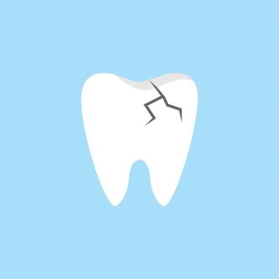 Cracked Tooth