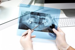 Dental Radiology