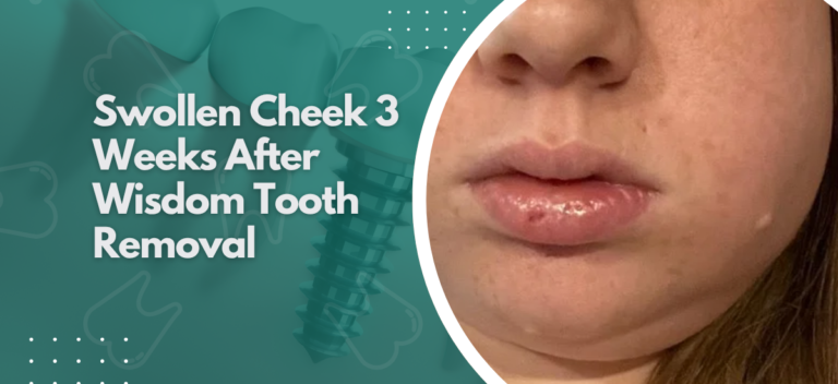 Swollen Cheek 3 Weeks After Wisdom Tooth Removal |Neo Dental