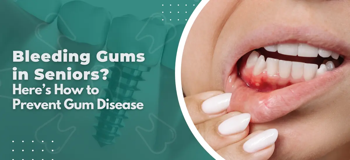 How to Prevent Gum Disease in Seniors with Bleeding Gums?