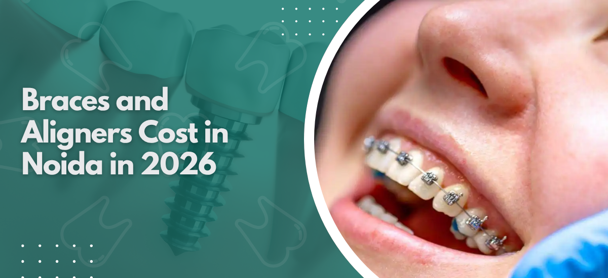 Braces and Aligners Cost in Noida in 2026