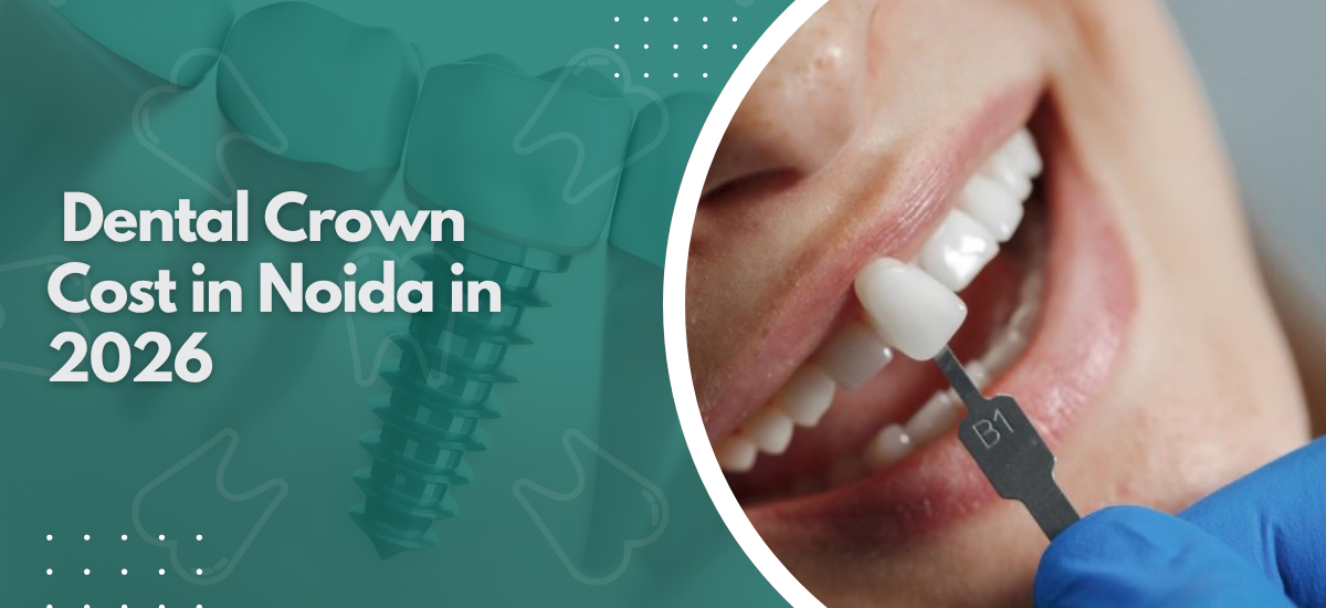 Dental Crown Cost in Noida in 2026