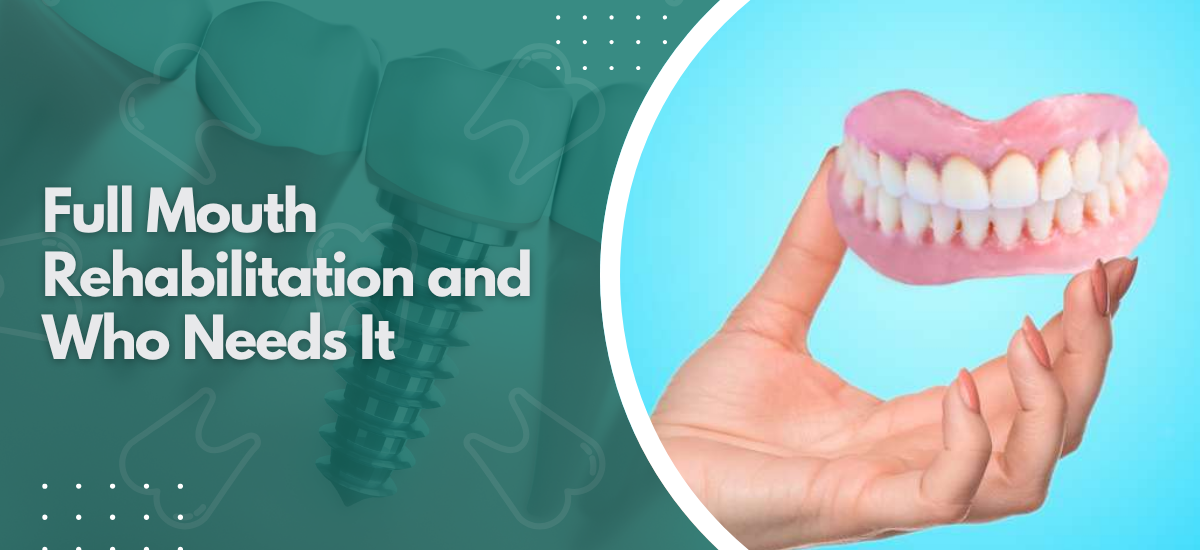 Full Mouth Rehabilitation and Who Needs It