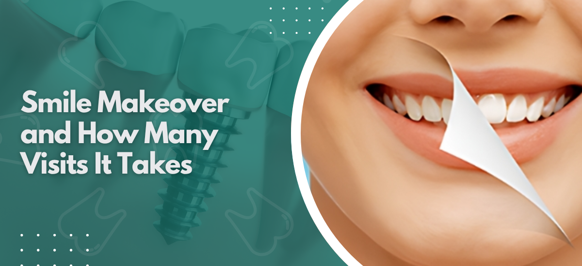 Smile Makeover and How Many Visits It Takes