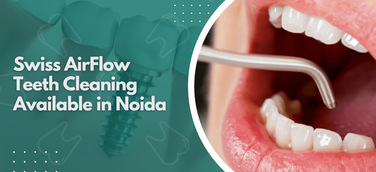 Swiss AirFlow Teeth Cleaning Available in Noida