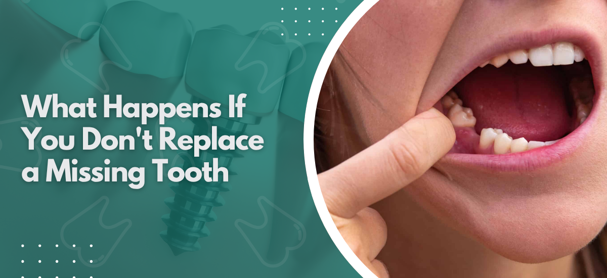 What Happens If You Don’t Replace a Missing Tooth