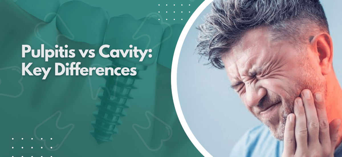 What Is Pulpitis and How Does It Differ From a Cavity?