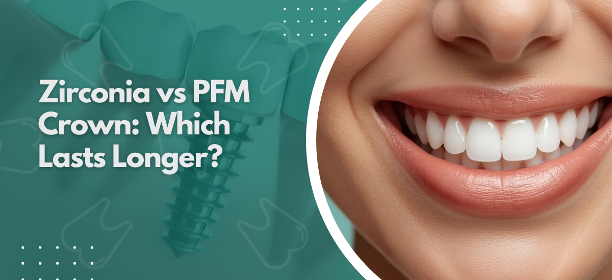 Zirconia vs PFM Crown: Which Lasts Longer?