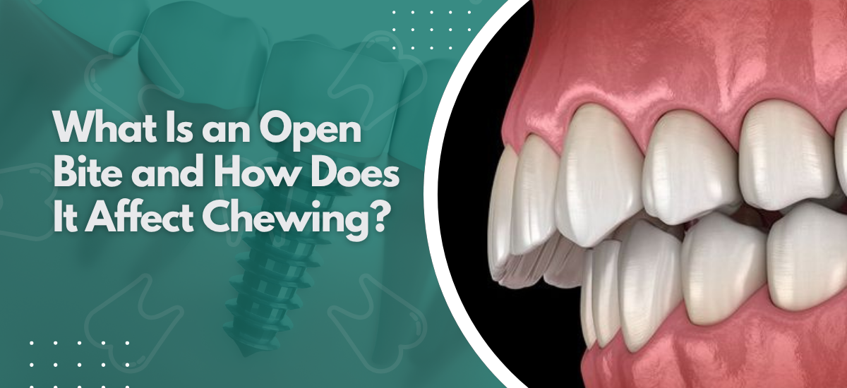 What Is an Open Bite and How Does It Affect Chewing?
