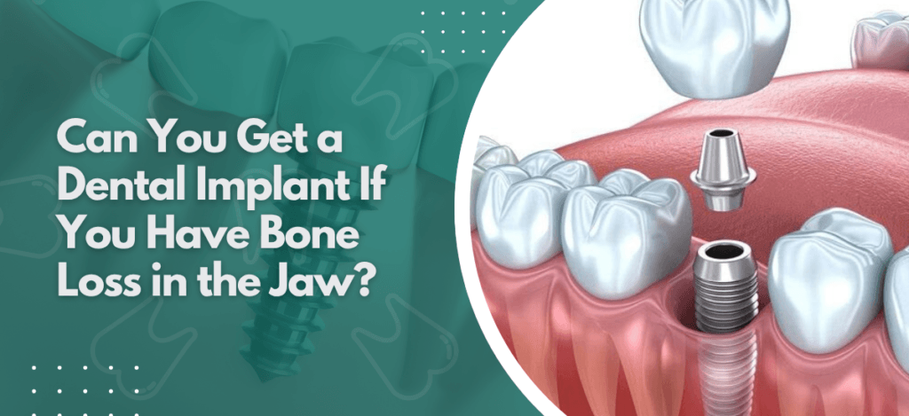 Can You Get a Dental Implant If You Have Bone Loss in the Jaw?