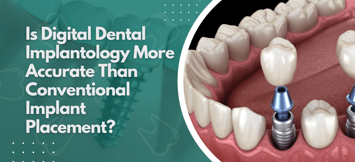 Is Digital Dental Implantology More Accurate Than Conventional Implant Placement?