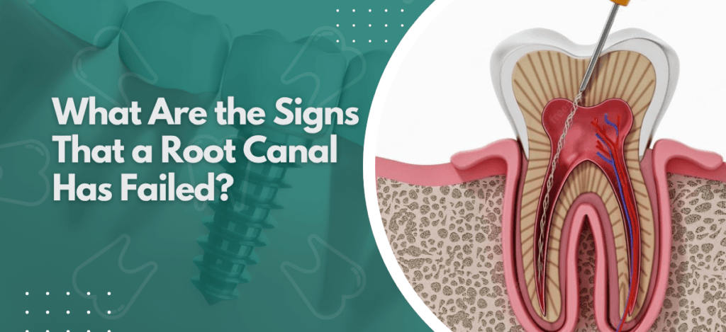 Neo Dental - blogs 20 | Neo Dental | Neo Dental A failed root canal has specific warning signs. Dr. Suhrab Singh explains what to look for, why failures happen, and when retreatment is the right next step.