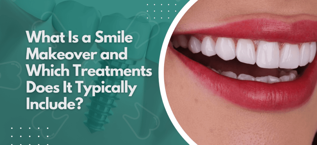 What Is a Smile Makeover and Which Treatments Does It Typically Include?