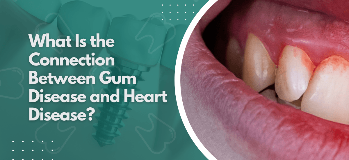 What Is the Connection Between Gum Disease and Heart Disease?