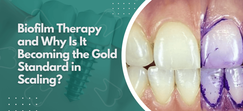 Neo Dental - blogs 30 | Neo Dental | Neo Dental What Is Guided Biofilm Therapy and Why Is It Becoming the Gold Standard in Scaling?