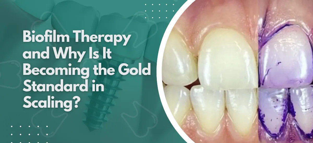What Is Guided Biofilm Therapy and Why Is It Becoming the Gold Standard in Scaling?