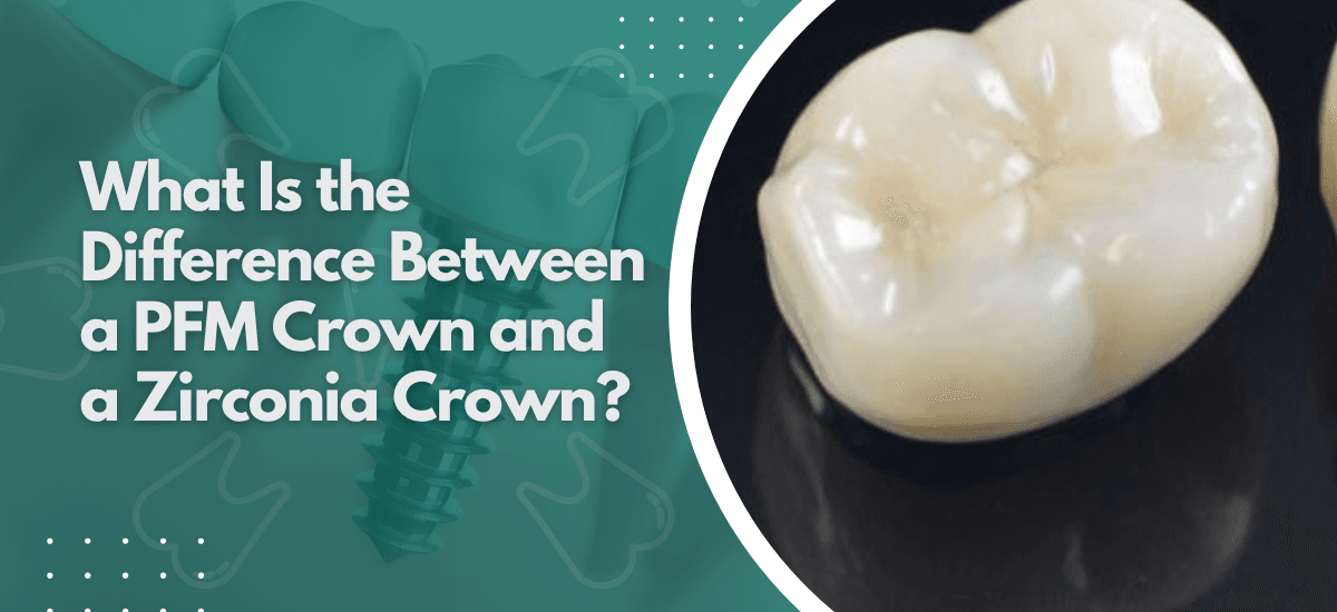 What Is the Difference Between a PFM Crown and a Zirconia Crown?