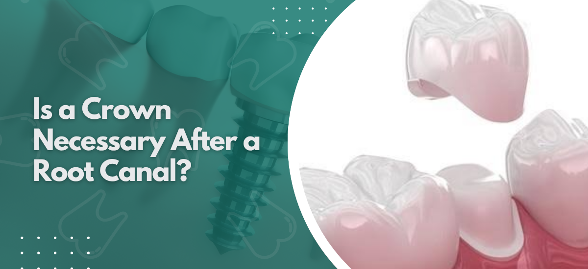 Is a Crown Necessary After a Root Canal?