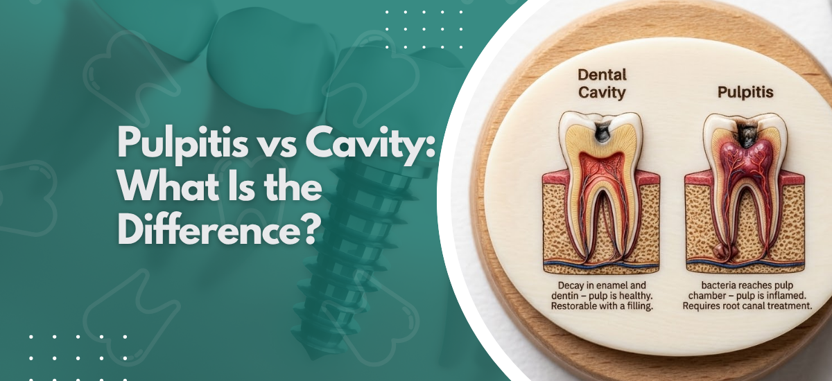 Pulpitis vs Cavity:What Is the Difference?