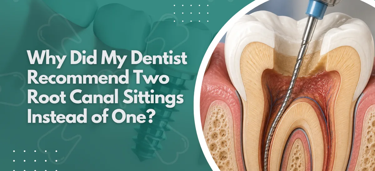 Why Did My Dentist Recommend Two Root Canal Sittings Instead of One?