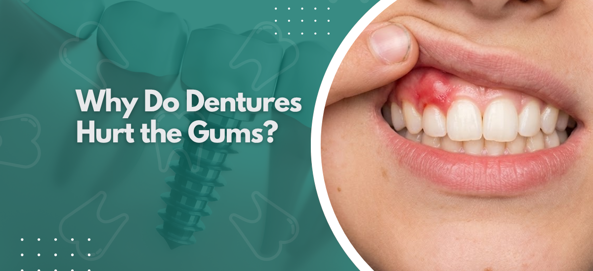 Why Do Dentures Hurt the Gums?