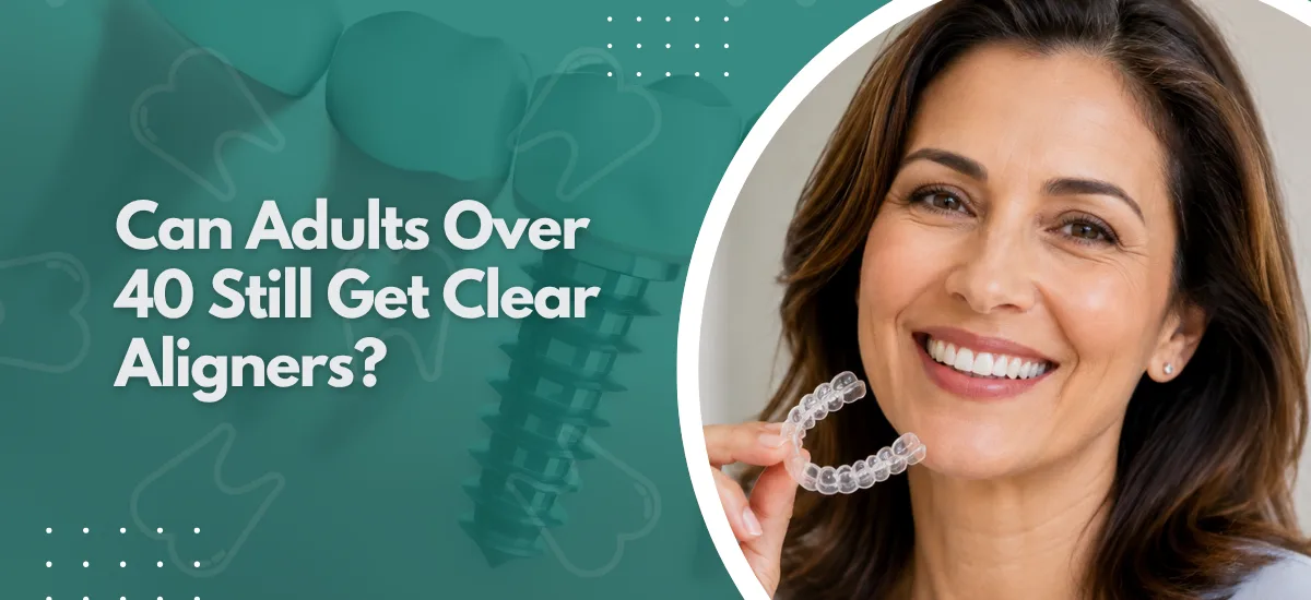 Can Adults Over 40 Still Get Clear Aligners?