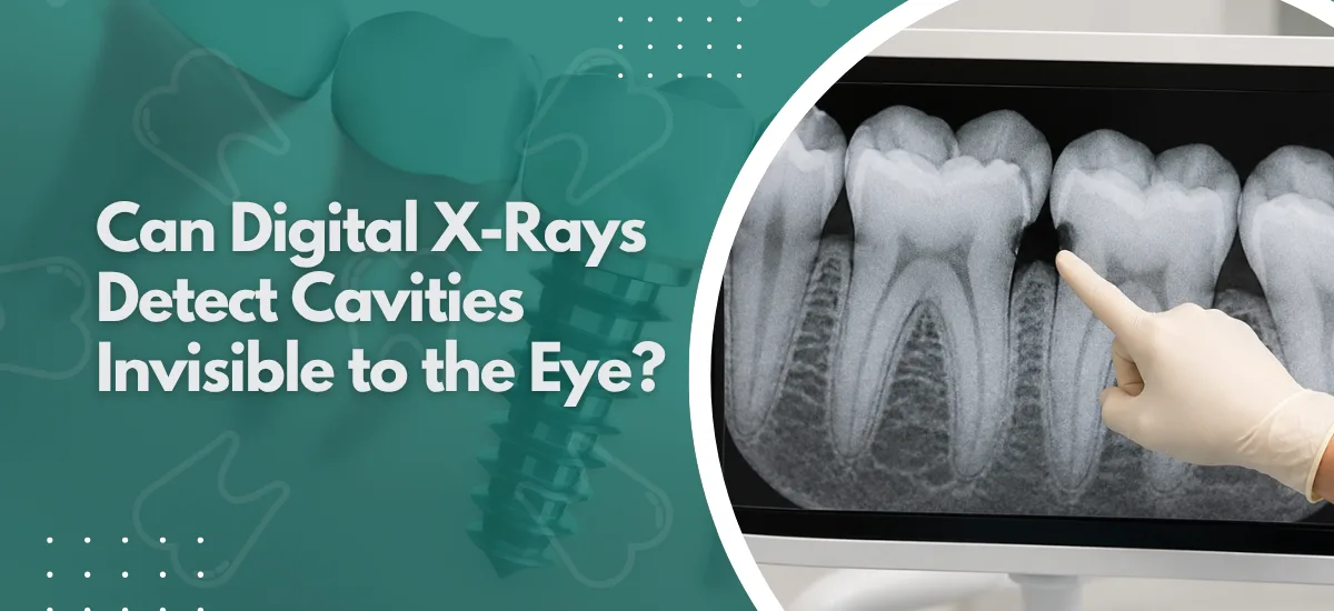 Can Digital X-Rays Detect Cavities Invisible to the Eye?