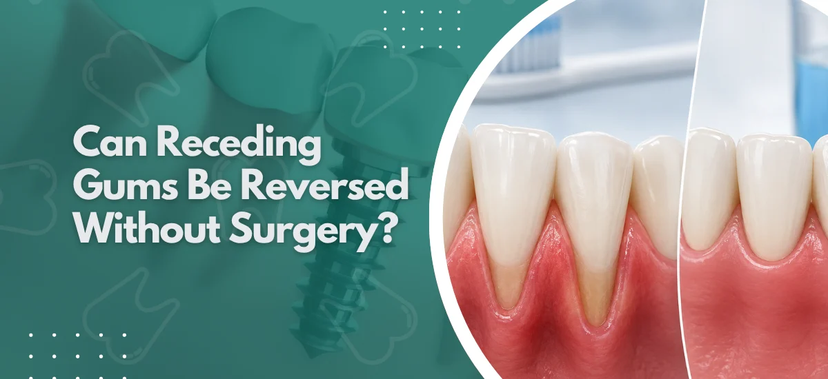 Can Receding Gums Be Reversed Without Surgery?