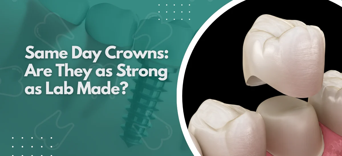 Same Day Crowns: Are They as Strong as Lab Made?