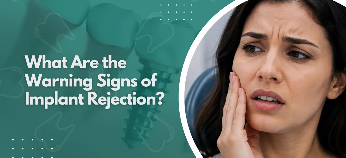 What Are the Warning Signs of Implant Rejection?
