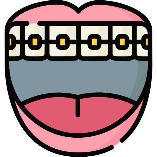 braces_2779568 | Neo Dental | Neo Dental Cartoon mouth smiling with braces on the upper teeth.