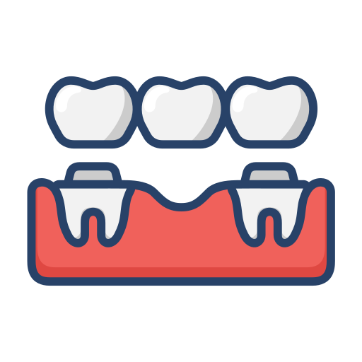 bridge | Neo Dental | Neo Dental Illustration of three teeth above a red dental impression tray used in dentistry.